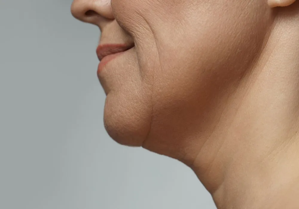 Saggy and ageing skin